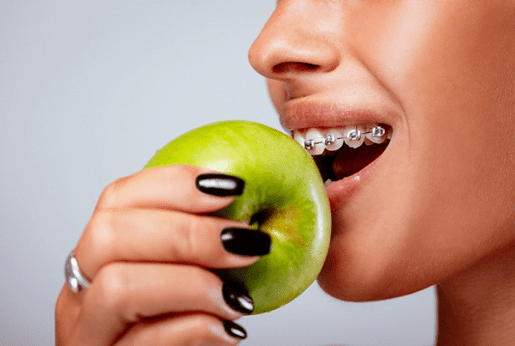 Essen mit Zahnspange: Tipps und Tricks