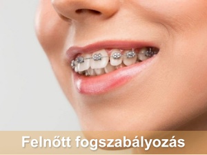 Szolgáltatások